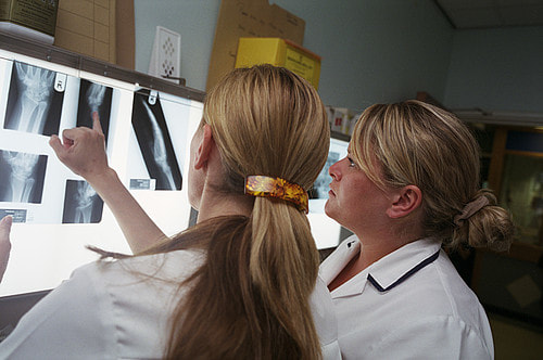 Two radiographers studying X-ray images